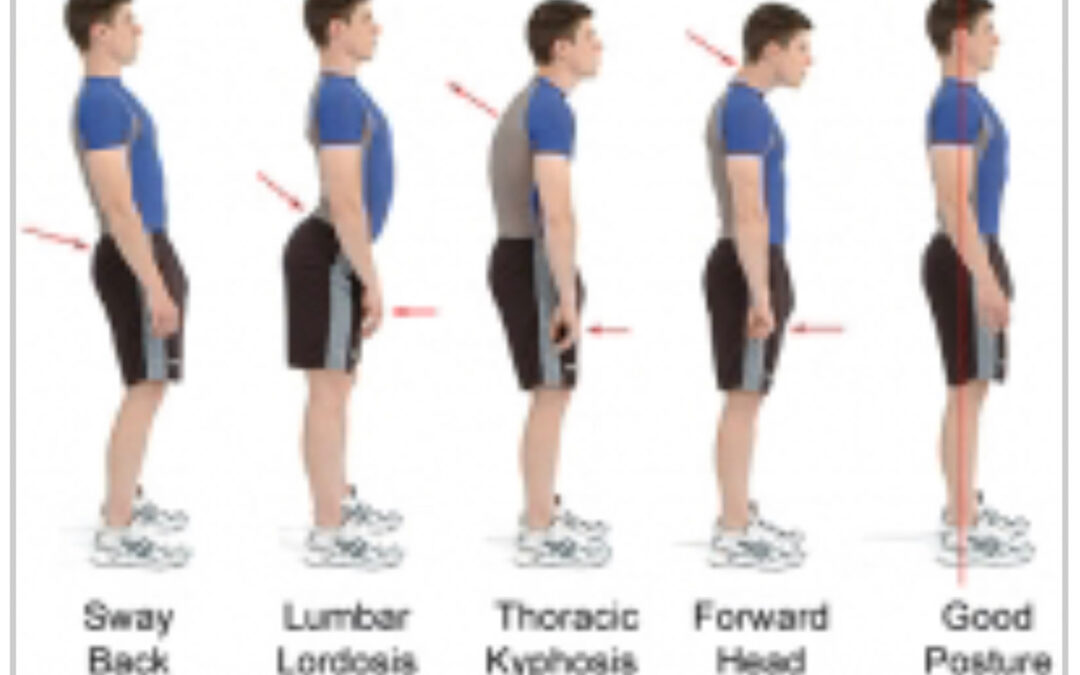 Posture- It Affects Your HEALTH Too!!!